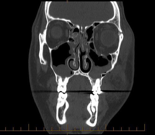 ctscan1
